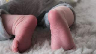 Noworodek wyglądał nietypowo