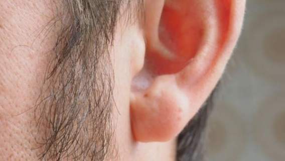Choroba objawia się na uszach
