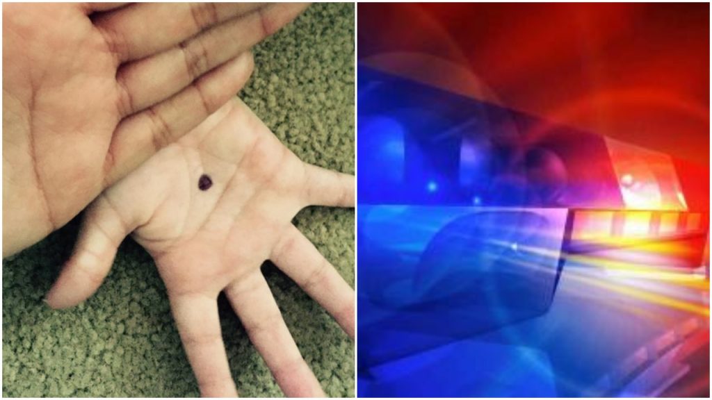 Jeśli widzisz kogoś z czarną kropką, dzwoń na policję!