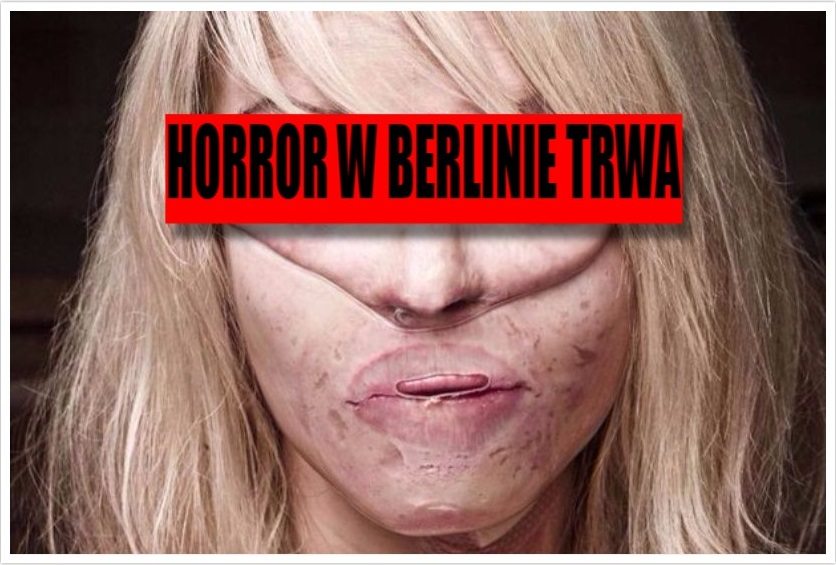 Niemcy bezsilni. Wyszły na jaw koszmarne ATAKI KWASEM na mieszkanki Berlina