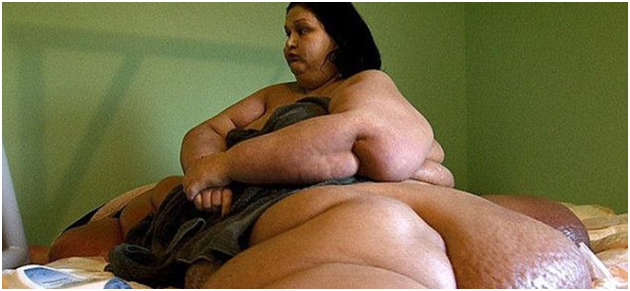 Ważyła 453 kilogramy i oskarżyli ją o morderstwo. Po kilku operacjach i diecie wygląda jak bogini (Zdjęcia)