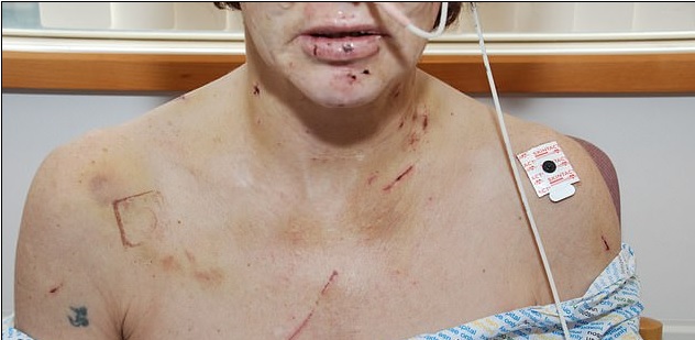 Żona przeżyła piekło, zdradza koszmarne szczegóły. Gdy pijany mąż wrócił do domu, rozpoczął rzeź, tylko dla ludzi o mocnych nerwach