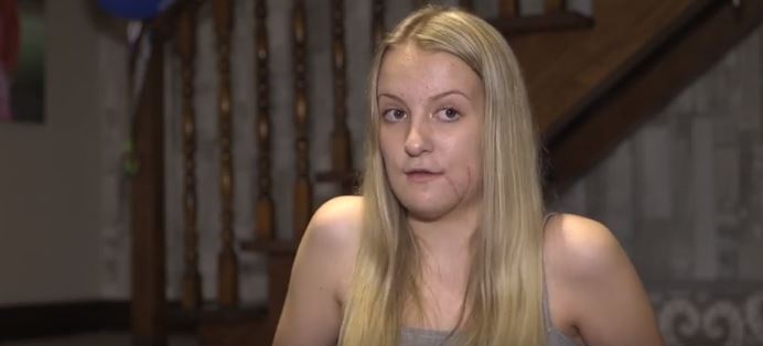 Spadła z konia, poczuła ogromny ból, w ręce wpadło jej coś czerwonego. Lekarze przyznali, że nigdy nie widzieli tak strasznych obrażeń