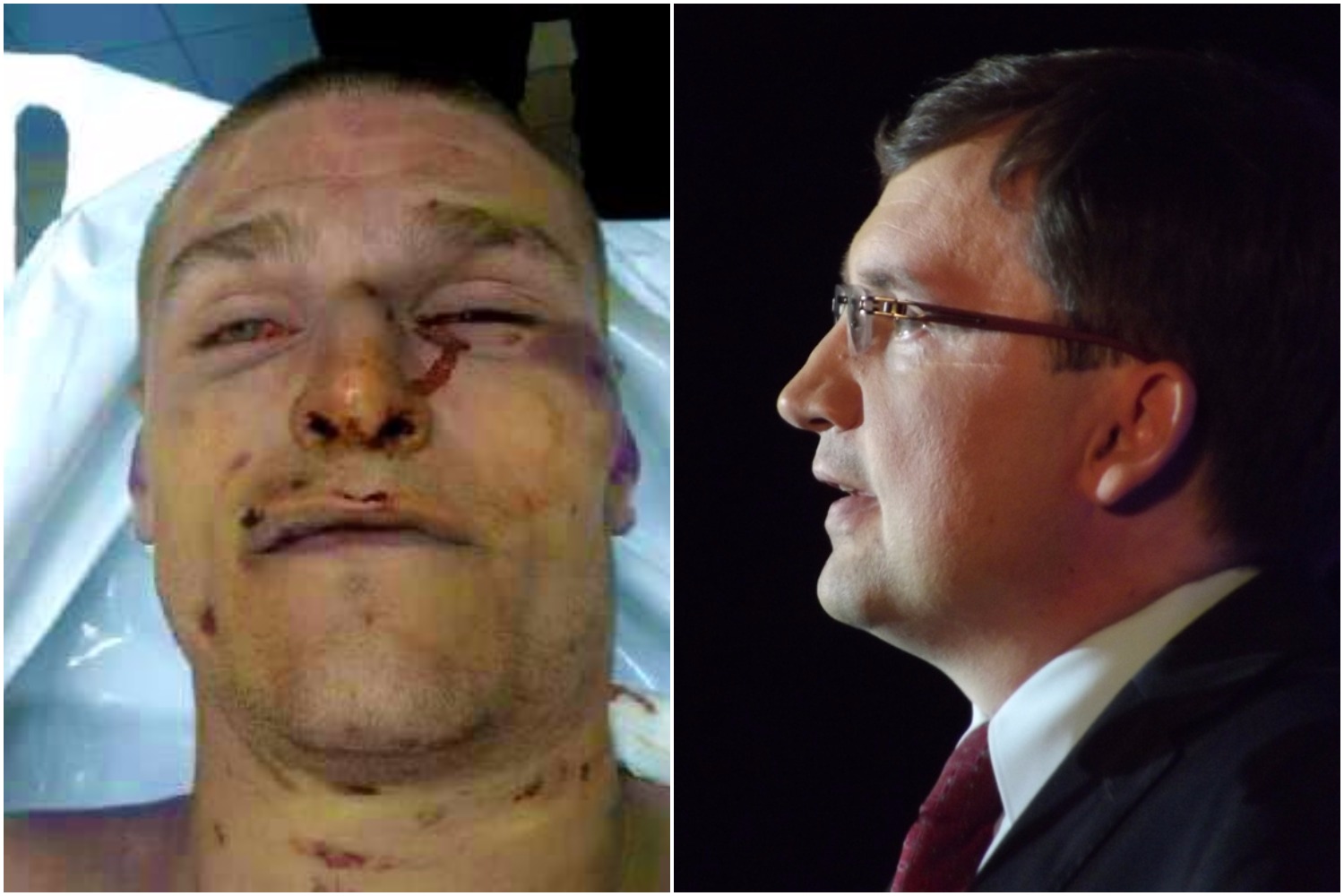 Internet nie dowierza. Ziobro: Policja nie biła Igora, zmarł od narkotyków