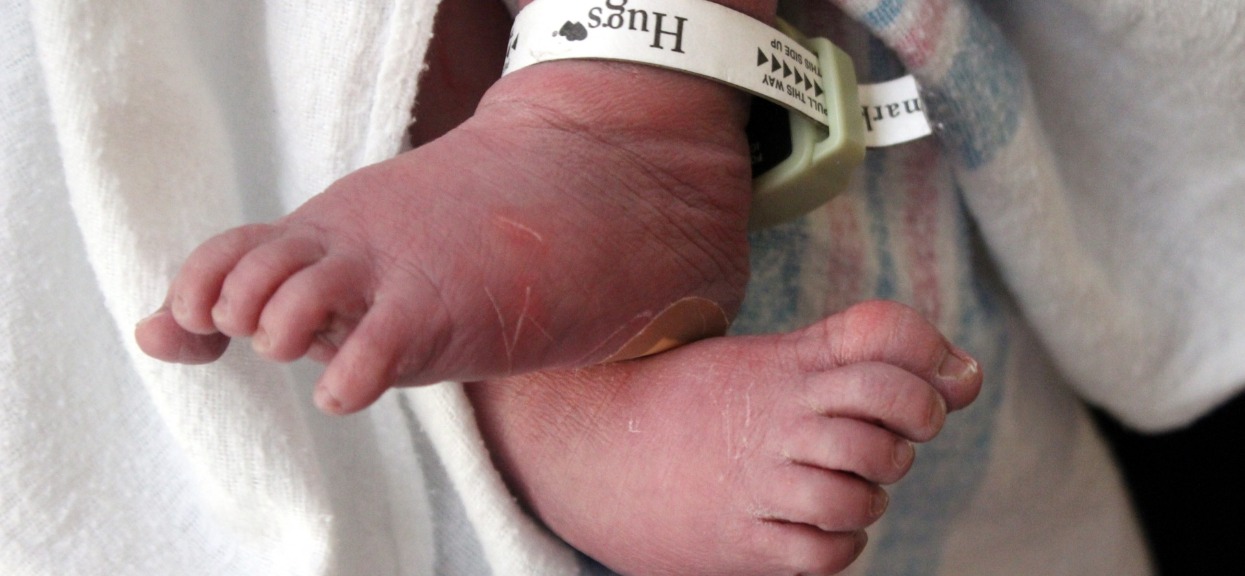 Położne aż zbladły, gdy zobaczyły jej synka. Mama spojrzała na jego twarz i sama omal nie zemdlała, nie spodziewała się takiego widoku