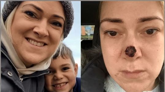Gosia ma 6 lat, przeszła 16 chemioterapii i poparzyła przełyk setkami tabletek. Nowotwór wykańcza ją w zastraszającym tempie, rodzice błagają o pomoc