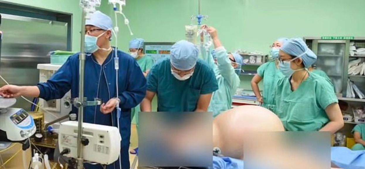 Jej brzuch zaczął rosnąć do gigantycznych rozmiarów. W szpitalu nigdy wcześniej nie widzieli takiego przypadku, wyciągnęli z niej przerażającą rzecz