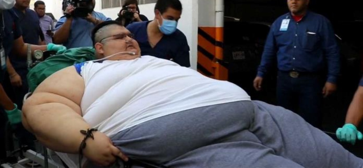Niewiarygodne, jak się zmienił najgrubszy człowiek świata. Schudł 330 kilogramów, nie przypomina dawnego siebie