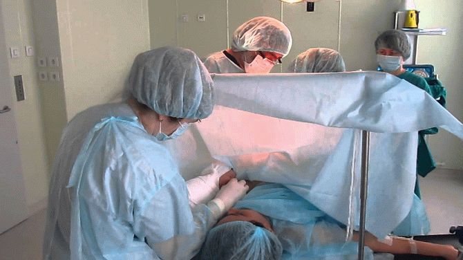 Lekarze otworzyli brzuch kobiety w ciąży. Od razu zrozumieli, że dziecka tam nie ma, szybko zaczęli działać