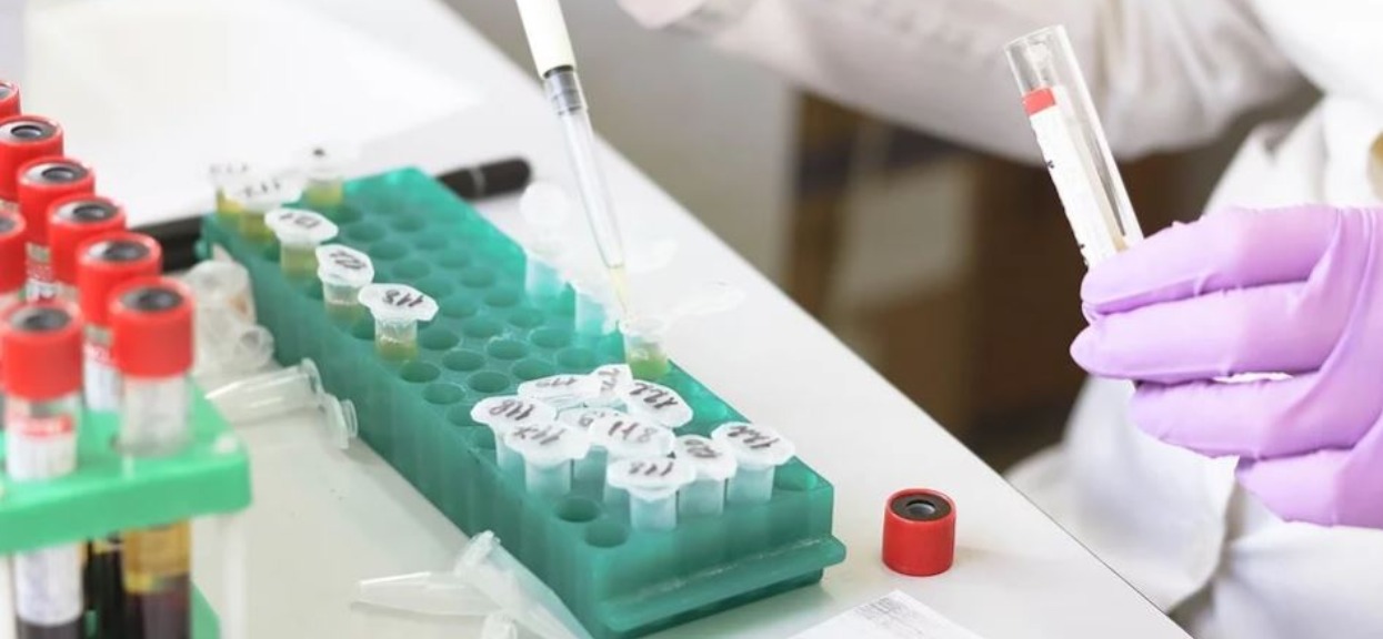Wystarczy zaledwie kilka minut. Przełomowy test na koronawirusa