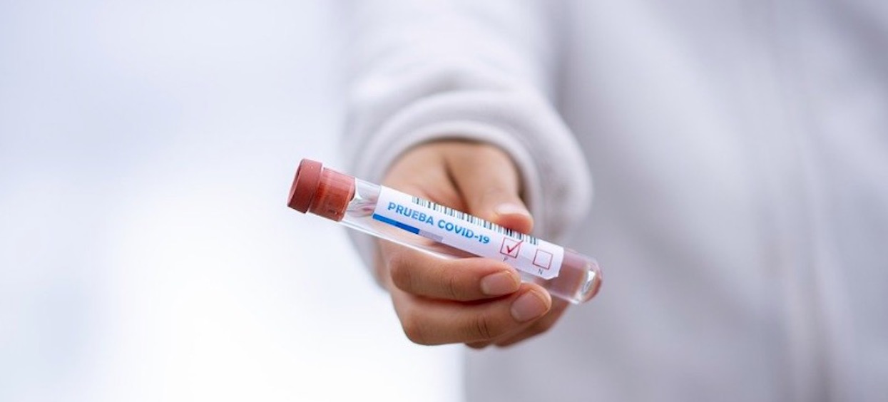 Po Śląsku pojawiło się nowe ognisko zapalne wirusa w innym miejscu? Już niemal trzycyfrowa liczba osób zakażonych w krótkim czasie