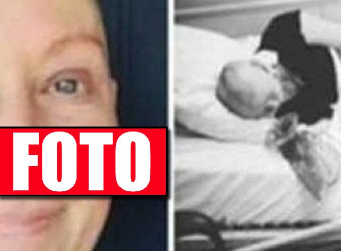 Znają ją wszyscy. Rak wyniszczył ją nie do poznania