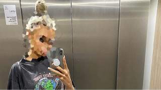 Zaczęła jeść dwa razy więcej niż zwykle. Z jej ciałem stały się niebywałe rzeczy, ciężko uwierzyć