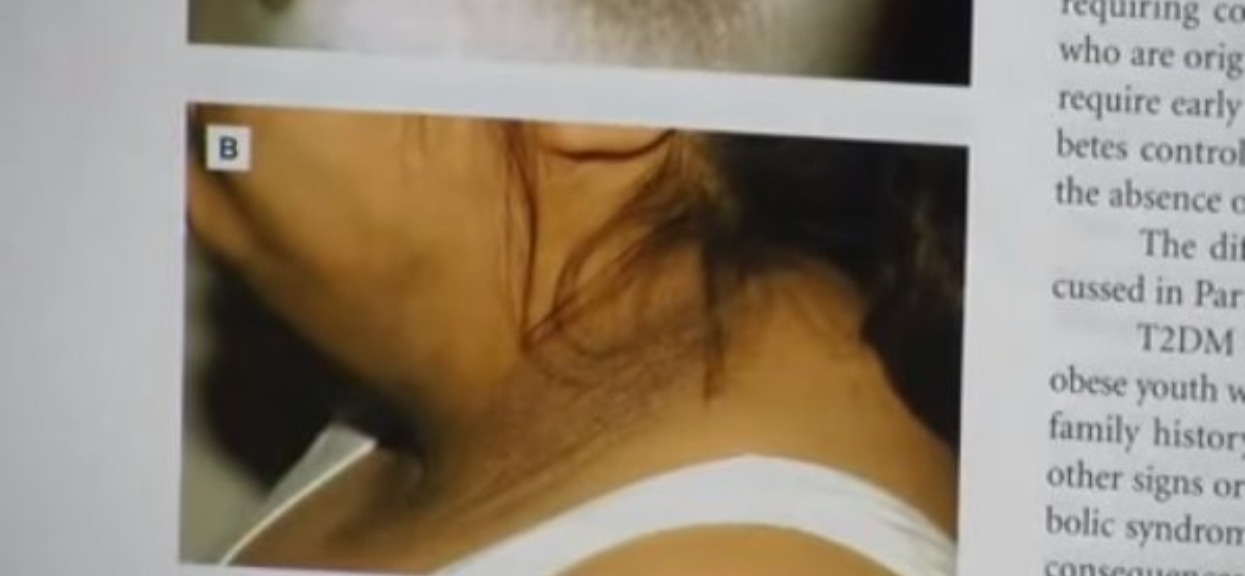 Mama była pewna, że jej dziecko ma po prostu brudną szyję. Gdy lekarz zdradził prawdziwy powód była totalnie załamana