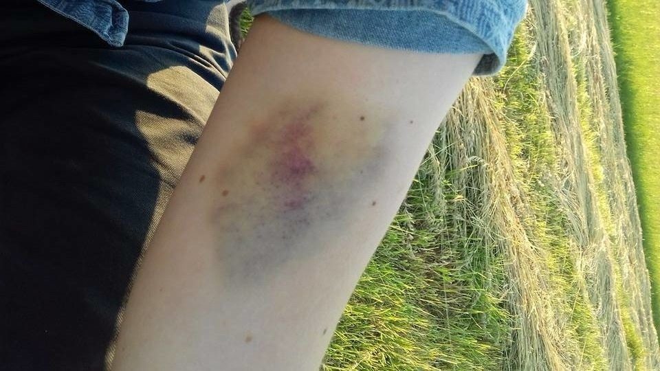 POBITO działacza Razem, a policja... ODMAWIA ścigania sprawcy