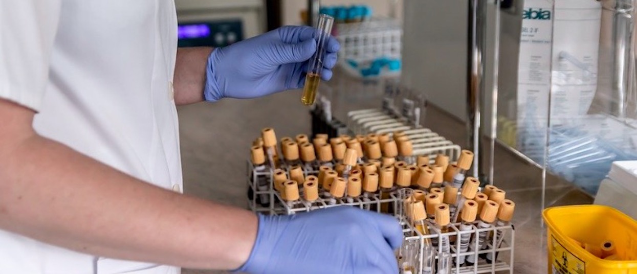 Właśnie ogłoszono koniec epidemii. Niesamowita wiadomość nagle obiegła media, wspaniałe informacje dla mieszkańców Konga