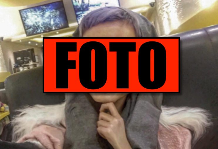 Chciała wyglądać jak Angelina Jolie. Teraz przypomina... POTWORA
