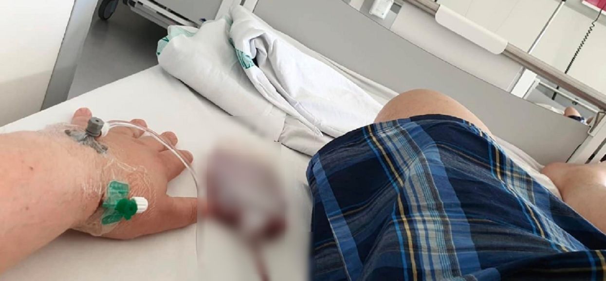 Czołowy polski polityk w szpitalu, konieczna była natychmiastowa, poważna operacja. W sieci pojawiły się porażające zdjęcia