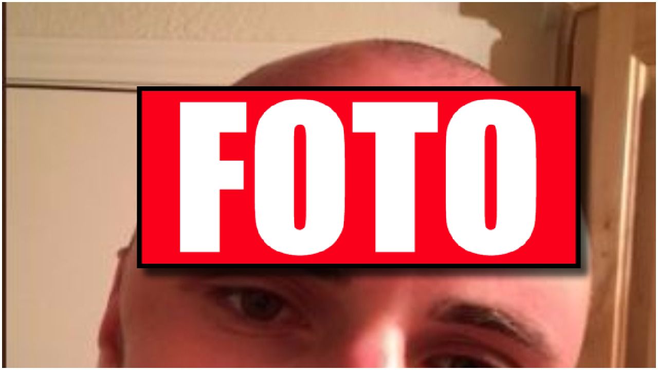 Co mu się stało?! Słońce zdeformowało mu głowę