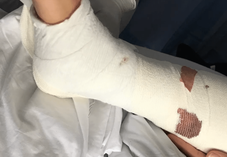 Dramat na święta, świat w furii. Polak w szale zmasakrował ciało geja