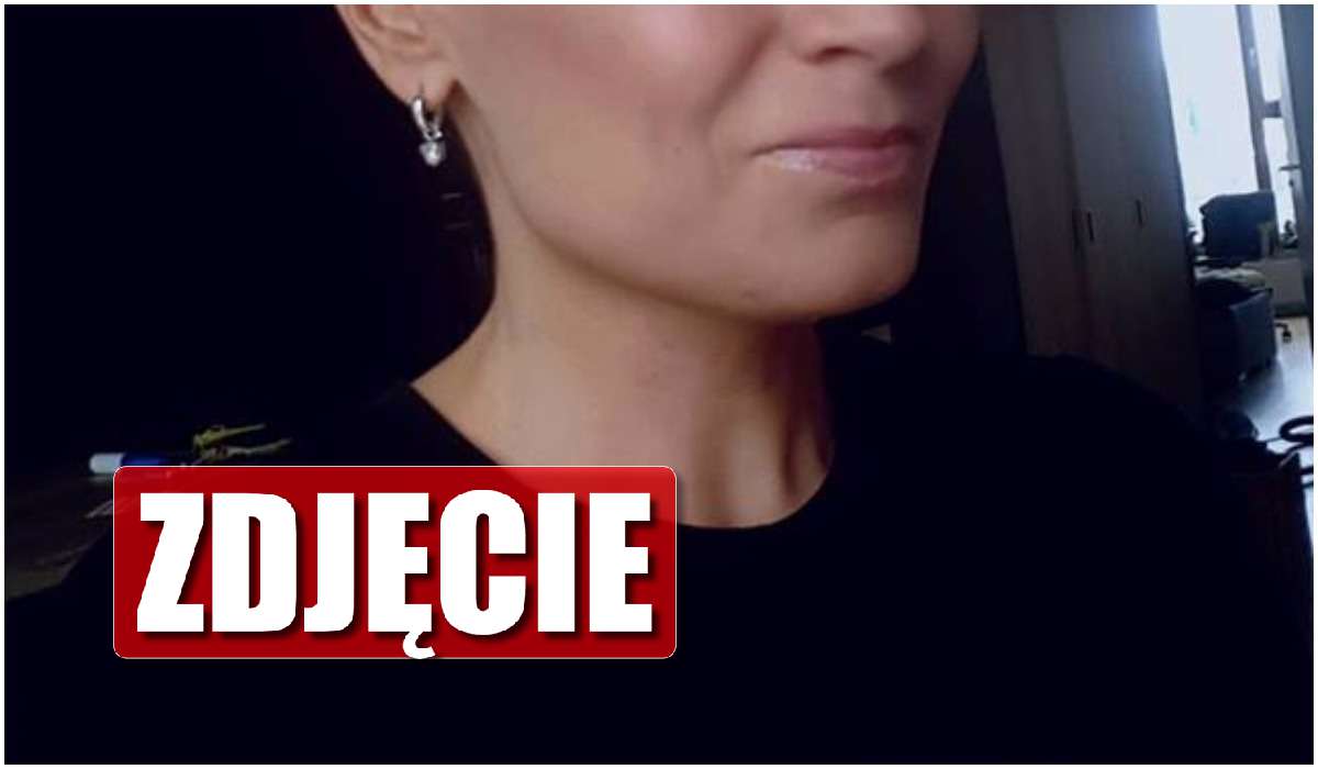 Słynna dziennikarka Polsatu ma raka. To straszne, co zrobił jej nowotwór