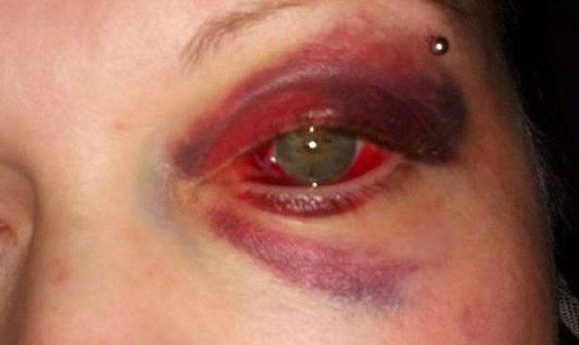 Przerażający widok! Justyna brutalnie skatowana przez policjanta!