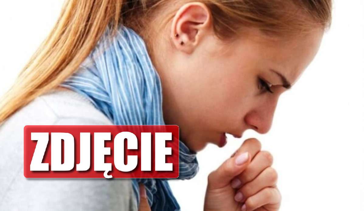 Koszmar! Nie mogła przestać kaszleć, to pojawiło się na jej ciele