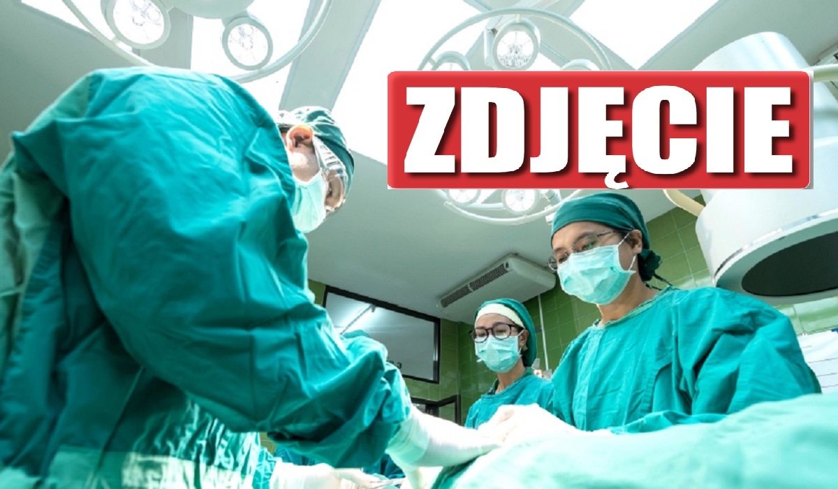 Szok! Przyszyli mu nogę tyłem naprzód