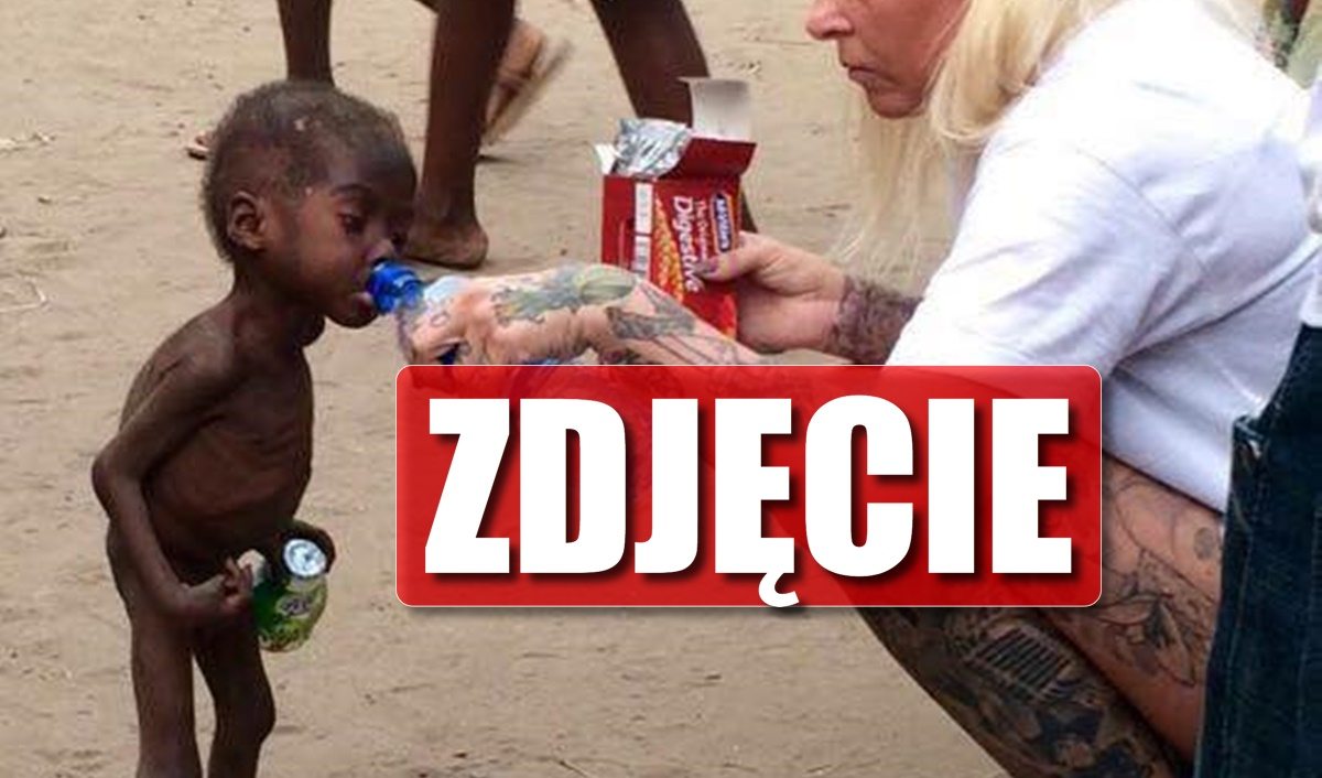 2 lata temu cudem przeżył. To jak wygląda dzisiaj wzrusza do łez