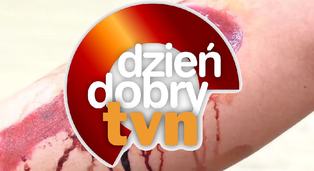 Jak poradzić sobie z krwawieniem? O tym musi dowiedzieć się każdy Polak