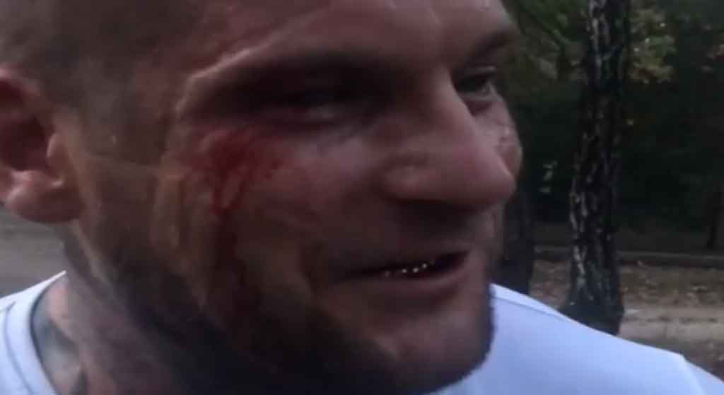Popek zakrwawiony biega po lesie! Szokujące nagranie krąży po sieci