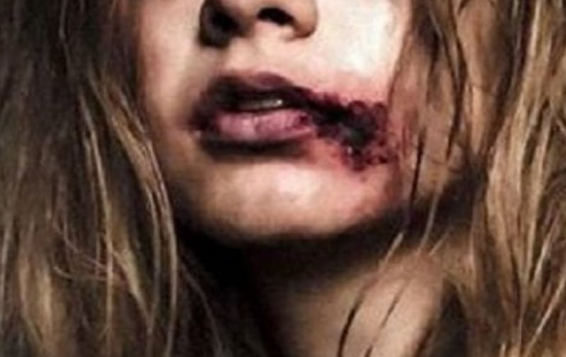 Gwiazda Polsatu pokazała brutalnie pobitą twarz. Szokujące zdjęcie