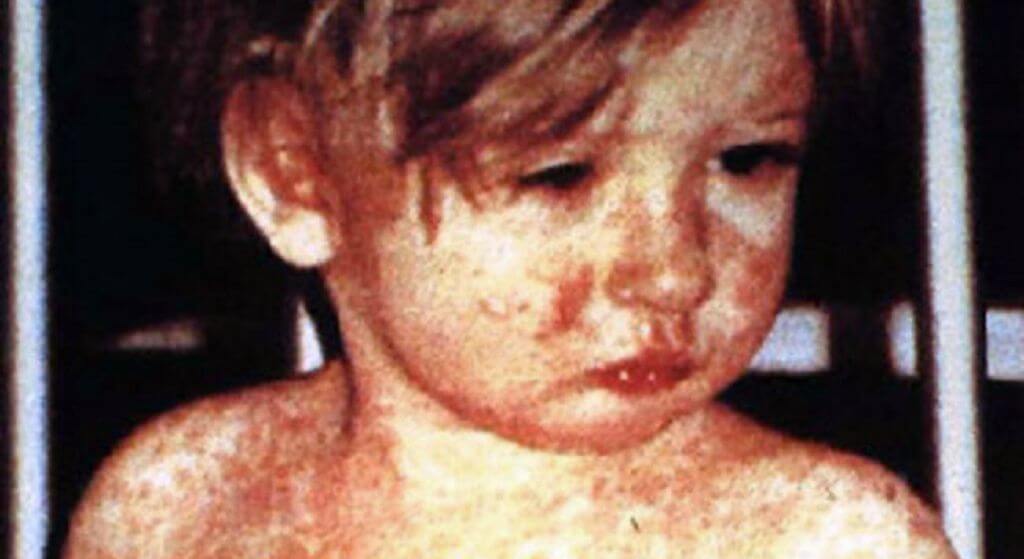 Zatrważające doniesienia mediów. Epidemia rozleje się na całą Polskę?