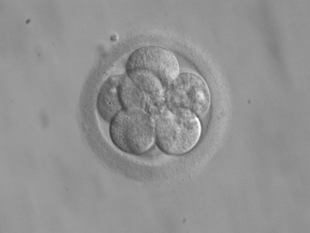 Szwecja: Chcą wprowadzić prawo do aborcji dla mężczyzn