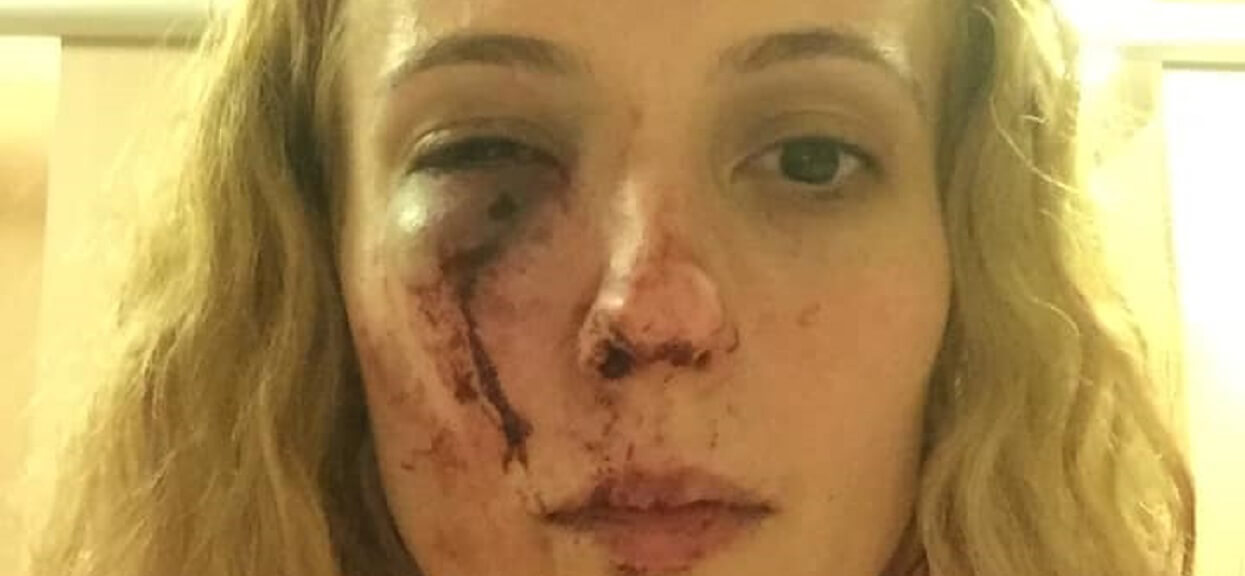 Została brutalnie pobita. Bo myśleli, że jest Polką
