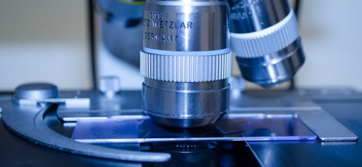Polacy stworzyli przełomowy test nowotworowy. Jest tak prosty, jak test ciążowy