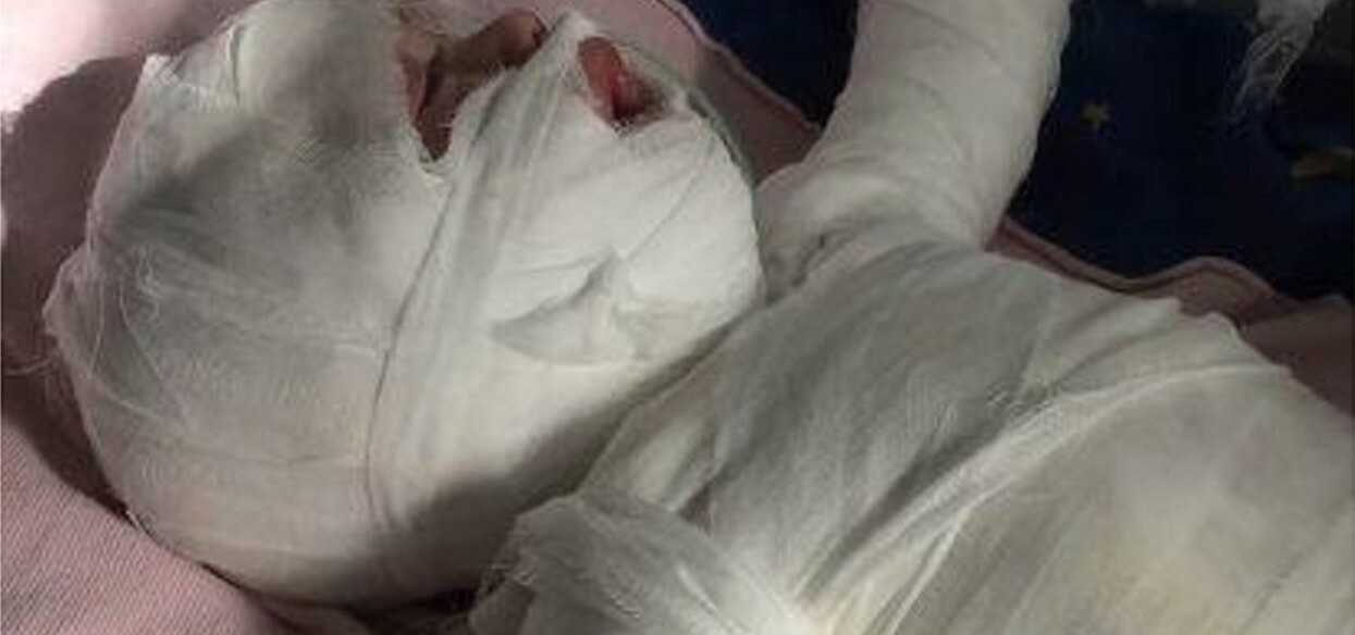 Mama rocznego chłopca odwróciła się tylko na 14 sekund. Wtedy stało się coś strasznego