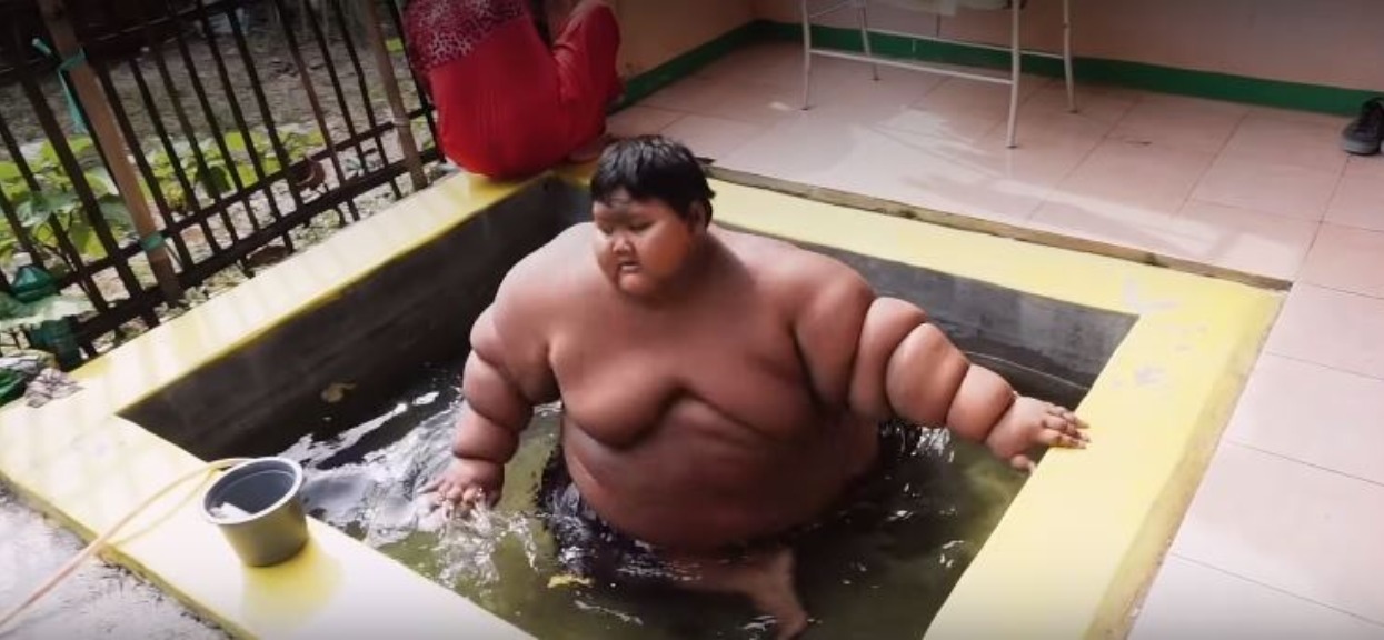 Chłopiec ważył ponad 200 kilogramów. To, jak wygląda teraz, zaskakuje