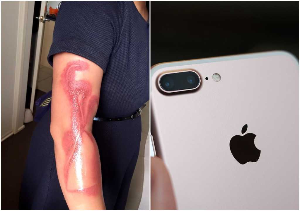 Najpierw Samsung, teraz kolejne telefony wybuchają. Poparzył kobietę w ciąży