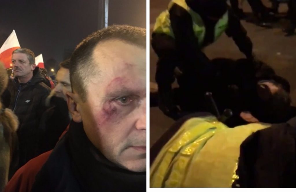 Nagrania z zamieszek pod Sejmem. Policja użyła siły, ambulansy zabrały rannych (video)